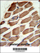 Formalin-fixed and paraffin-embedded human skeletal muscle reacted with ACTR3 Antibody (C-term), which was peroxidase-conjugated to the secondary antibody, followed by DAB staining. This data demonstrates the use of this antibody for immunohistochemistry;