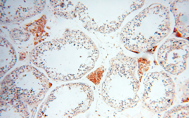 Immunohistochemical of paraffin-embedded human testis using Catalog No:111844(INPP5E antibody) at dilution of 1:50 (under 10x lens)