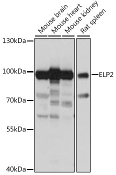Western blot - ELP2 Polyclonal Antibody 