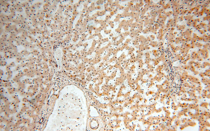 Immunohistochemical of paraffin-embedded human liver using Catalog No:115866(TBC1D23 antibody) at dilution of 1:100 (under 10x lens)