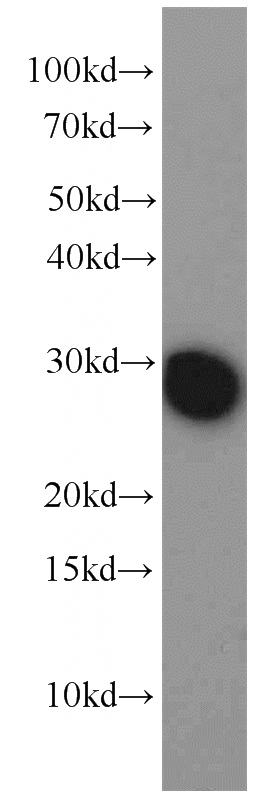 HEK-293 cells were subjected to SDS PAGE followed by western blot with Catalog No:108421(BCAP31 antibody) at dilution of 1:2000