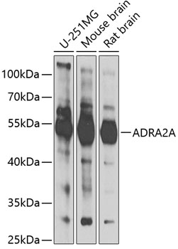 Western blot - ADRA2A Polyclonal Antibody 