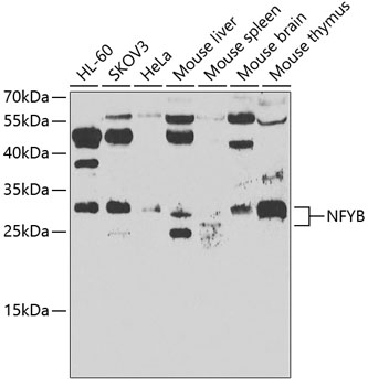 Western blot - NFYB Polyclonal Antibody 