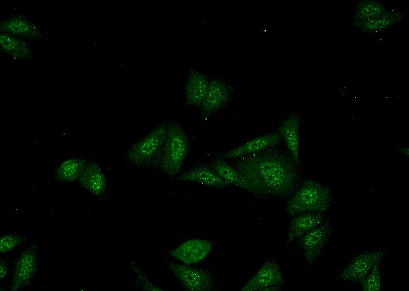 Immunofluorescent analysis of (-20oc Ethanol) fixed HepG2 cells using Catalog No:115026(SDCCAG10 Antibody) at dilution of 1:50 and Alexa Fluor 488-congugated AffiniPure Goat Anti-Rabbit IgG(H+L)