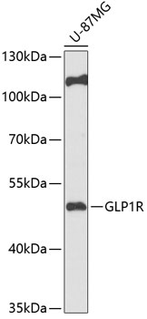 Western blot - GLP1R Polyclonal Antibody 