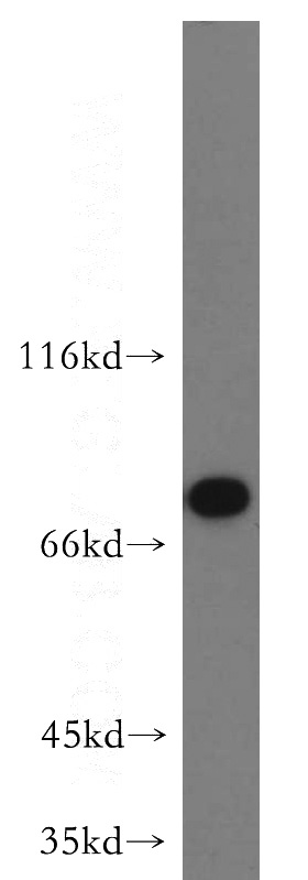 HeLa cells were subjected to SDS PAGE followed by western blot with Catalog No:113002(MYSM1-Specific antibody) at dilution of 1:300
