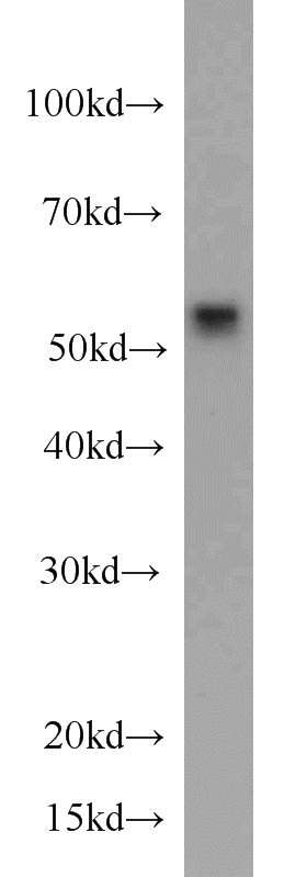 K-562 cells were subjected to SDS PAGE followed by western blot with Catalog No:107218(FKBP52 antibody) at dilution of 1:500