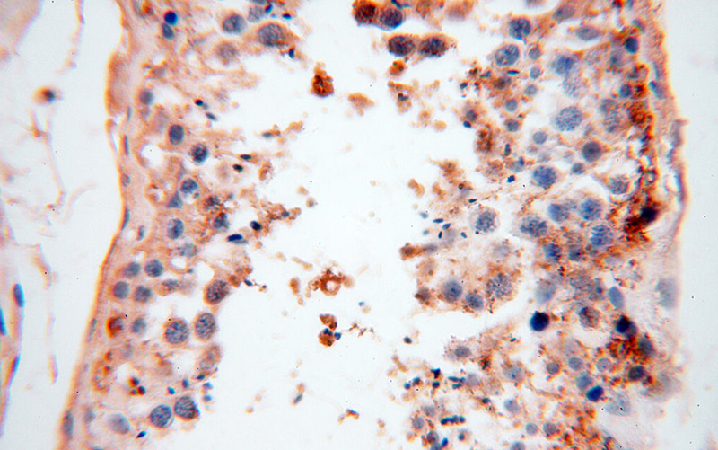Immunohistochemical of paraffin-embedded human testis using Catalog No:109601(CSNK1A1L antibody) at dilution of 1:100 (under 40x lens)