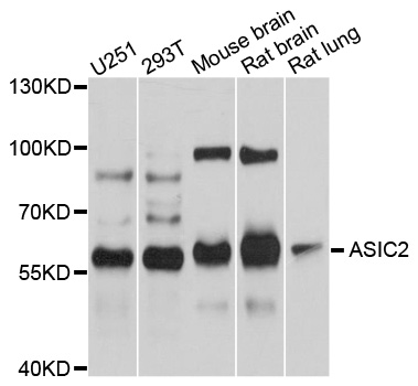Western blot - ASIC2 Polyclonal Antibody 