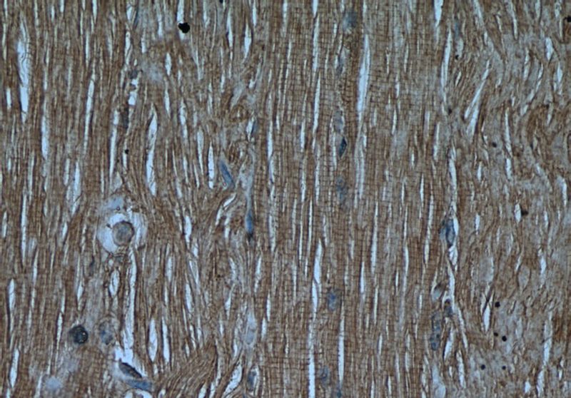 Immunohistochemical of paraffin-embedded human skeletal muscle using Catalog No:108921(CAMK2G antibody) at dilution of 1:50 (under 40x lens)