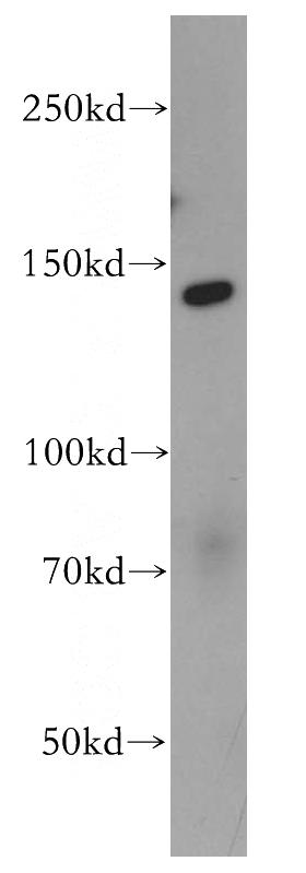 Jurkat cells were subjected to SDS PAGE followed by western blot with Catalog No:110228(EHMT2 antibody) at dilution of 1:400