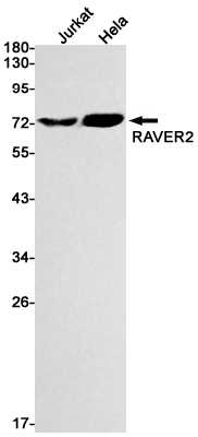 Western blot detection of RAVER2 in Jurkat,Hela cell lysates using RAVER2 Rabbit mAb(1:1000 diluted).Predicted band size:74kDa.Observed band size:74kDa.