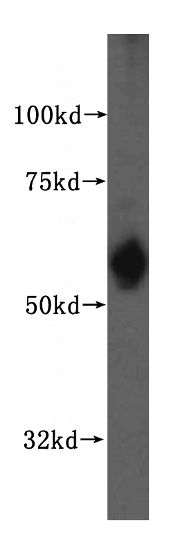 HepG2 cells were subjected to SDS PAGE followed by western blot with Catalog No:115073(SDSL antibody) at dilution of 1:700