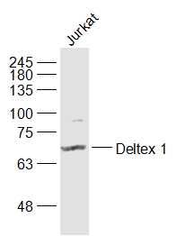 Fig2: Sample:; Jurkat(Human) Cell Lysate at 30 ug; Primary: Anti-Deltex 1 at 1/1000 dilution; Secondary: IRDye800CW Goat Anti-Rabbit IgG at 1/20000 dilution; Predicted band size: 67 kD; Observed band size: 67 kD