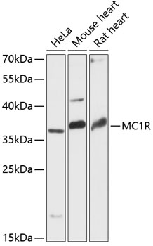 Western blot - MC1R Polyclonal Antibody 