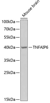 Western blot - TNFAIP6 Polyclonal Antibody 