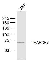 Fig3: Sample:; Siha(Human) Cell Lysate at 30 ug; U251(Human) Cell Lysate at 30 ug; Primary: Anti-MARCH7 at 1/500 dilution; Secondary: IRDye800CW Goat Anti-Rabbit IgG at 1/20000 dilution; Predicted band size: 78 kD; Observed band size: 73 kD