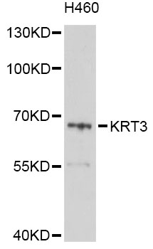 Western blot - KRT3 Polyclonal Antibody 