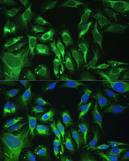 Immunofluorescence - OGN Polyclonal Antibody 