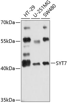 Western blot - SYT7 Polyclonal Antibody 