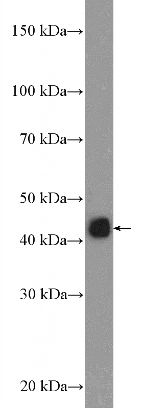 Jurkat cells were subjected to SDS PAGE followed by western blot with Catalog No:111416(HLA class I (HLA-C) Antibody) at dilution of 1:1000