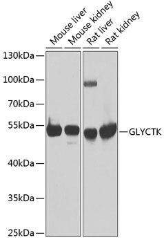 Western blot - GLYCTK Polyclonal Antibody 
