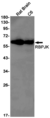 Western blot detection of RBPJK in Rat Brain,C6 cell lysates using RBPJK Rabbit pAb(1:1000 diluted).Predicted band size:56kDa.Observed band size:61kDa.