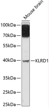 Western blot - KLRD1 Polyclonal Antibody 