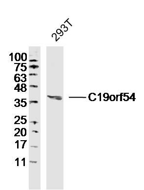 Fig1: Sample: 293T Cell (Human) Lysate at 30 ug; Primary: Anti- C19orf54 at 1/300 dilution; Secondary: IRDye800CW Goat Anti-Rabbit IgG at 1/20000 dilution; Predicted band size: 38kD; Observed band size: 38kD
