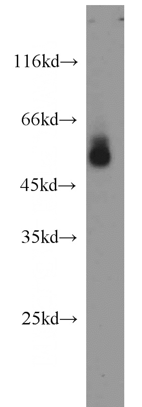 human blood tissue were subjected to SDS PAGE followed by western blot with Catalog No:108038(APOH antibody) at dilution of 1:1000