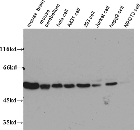 WB results on multiple cells/tissues with anti-Tubulin-beta (Catalog No:117306) at dilution 1:1,000.