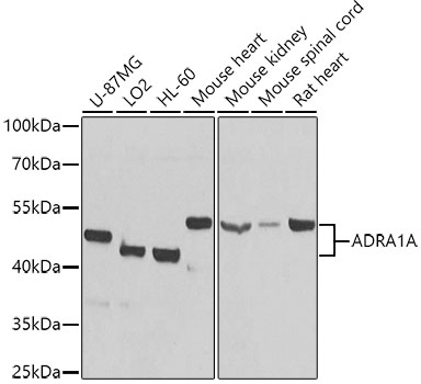 Western blot - ADRA1A Polyclonal Antibody 