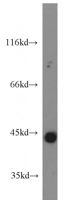 Recombinant protein were subjected to SDS PAGE followed by western blot with Catalog No:111869(IFNG antibody) at dilution of 1:2000