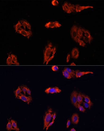 Immunofluorescence - FAP Polyclonal Antibody 