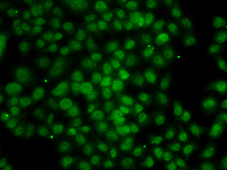 Immunofluorescence - ATMIN Polyclonal Antibody 