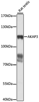 Western blot - AKAP3 Polyclonal Antibody 