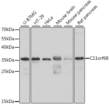 Western blot - C11orf68 Polyclonal Antibody 