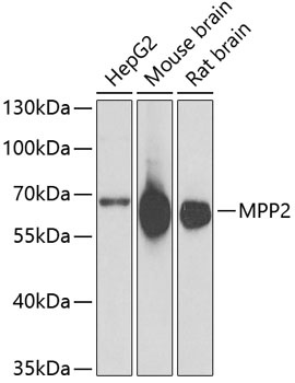 Western blot - MPP2 Polyclonal Antibody 
