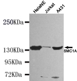Western blot detection of SMC1A(N-terminus) in HelaNE,Jurkat and A431 cell lysates using SMC1A (N-terminus) mouse mAb (1:1000 diluted).Predicted band size: 143KDa.Observed band size: 143KDa.