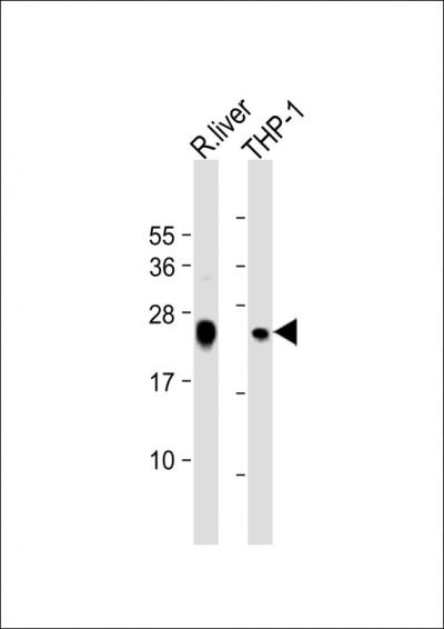 All lanes: Anti-GPX1 Antibody (C-term) at 1:2000 dilutionnLane 1: rat liver lysatenLane 2: THP-1 whole cell lysatennLysates/proteins at 20 u03bcg per lane. nnSecondarynGoat Anti-Rabbit IgG,  (H+L), Peroxidase conjugated at 1/10000 dilution. nnPredicted band size: 22 kDannBlocking/Dilution buffer: 5% NFDM/TBST.