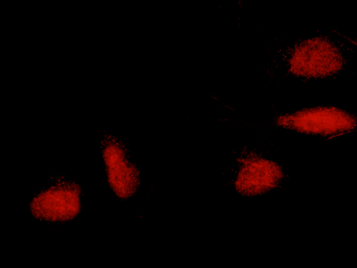 ERCC8 / CSA Antibody, Rabbit PAb, Antigen Affinity Purified, Immunofluorescence