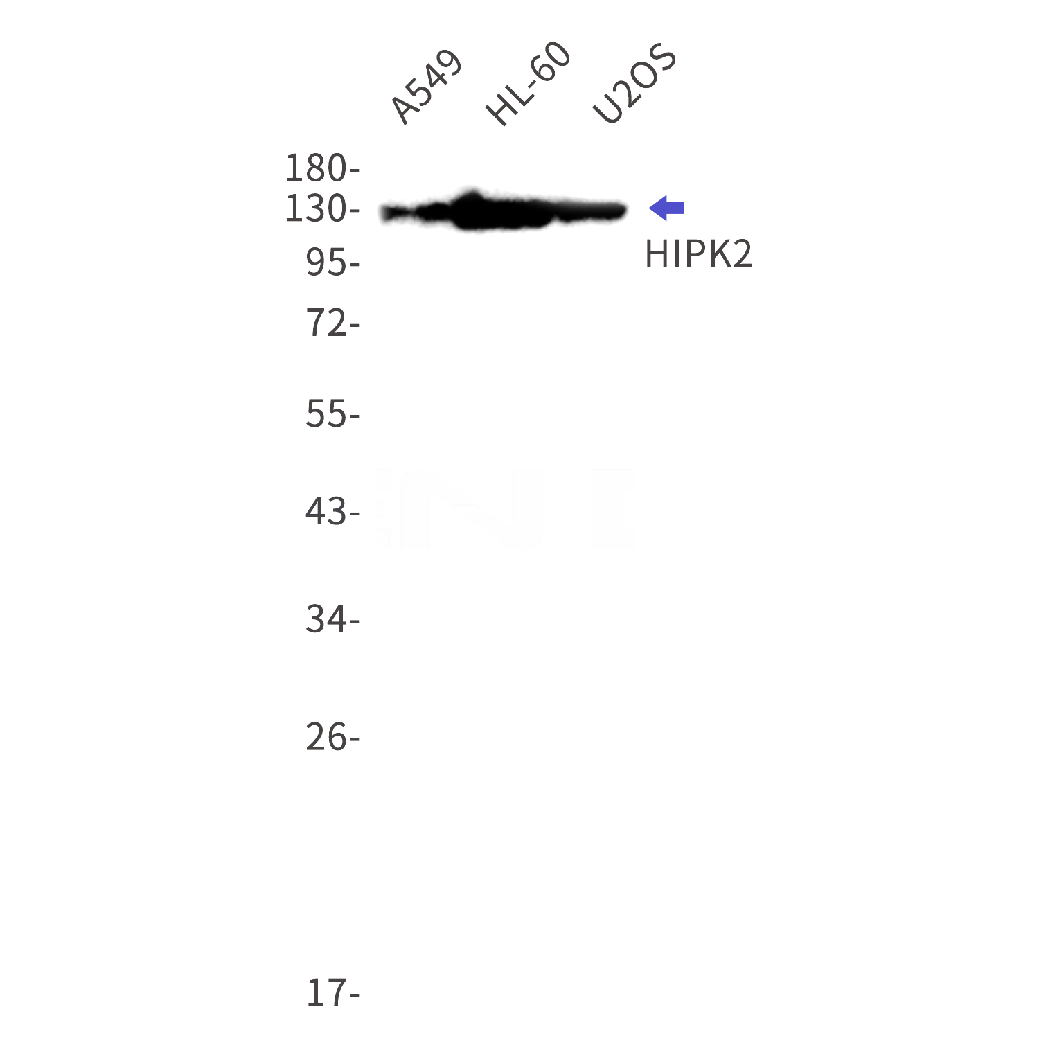 Western blot detection of HIPK2 in A549,HL-60,U2OS cell lysates using HIPK2 Rabbit mAb(1:1000 diluted).Predicted band size:131kDa.Observed band size:131kDa.