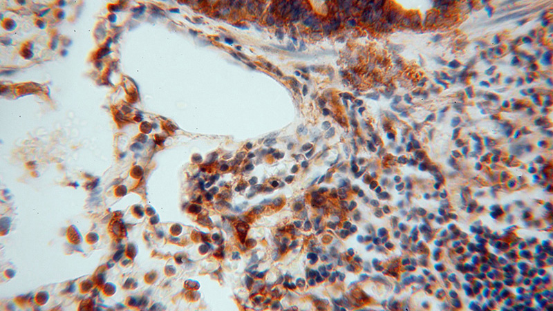 Immunohistochemical of paraffin-embedded human lung using Catalog No:112907(MVP antibody) at dilution of 1:50 (under 40x lens)