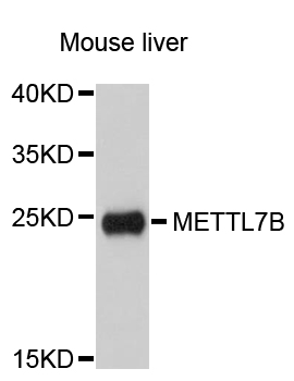 Western blot - METTL7B Polyclonal Antibody 