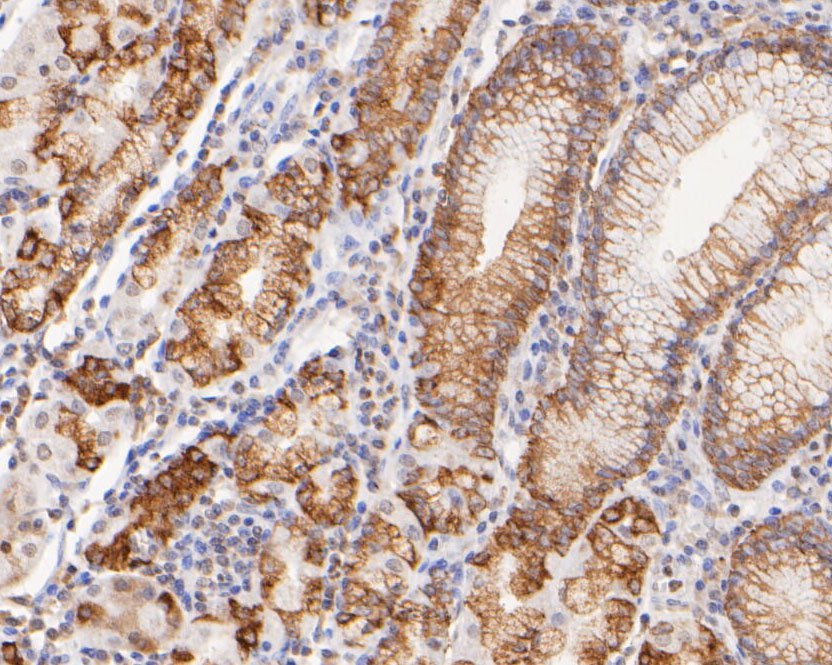 Fig3:; Immunohistochemical analysis of paraffin-embedded human Stomach tissue using anti-FAT1 antibody. The section was pre-treated using heat mediated antigen retrieval with sodium citrate buffer (pH 6.0) for 20 minutes. The tissues were blocked in 5% BSA for 30 minutes at room temperature, washed with ddH; 2; O and PBS, and then probed with the primary antibody ( 1/100) for 1 hour at room temperature. The detection was performed using an HRP conjugated compact polymer system. DAB was used as the chromogen. Tissues were counterstained with hematoxylin and mounted with DPX.