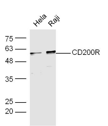 Fig1: Sample:hela(Human) Cell Lysate at 30 ug; Raji(Human) Cell Lysate at 30 ug; Primary: Anti-CD200R at 1/300 dilution; Secondary: IRDye800CW Goat Anti-Rabbit IgG at 1/20000 dilution; Predicted band size: 33 kD; Observed band size: 58 kD