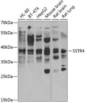 Western blot - SSTR4 Polyclonal Antibody 