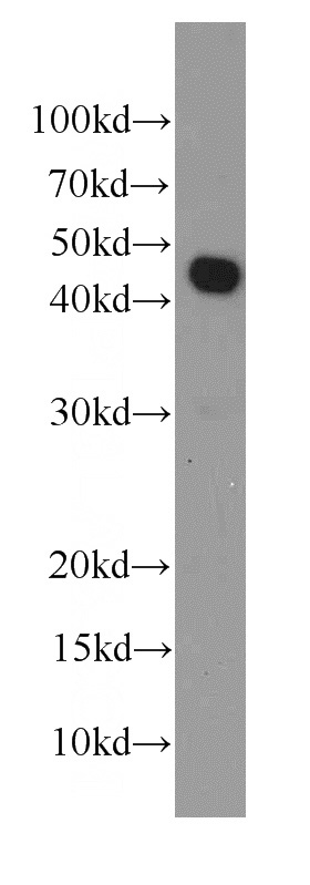 HEK-293 cells were subjected to SDS PAGE followed by western blot with Catalog No:107509(RPL3 antibody) at dilution of 1:1000