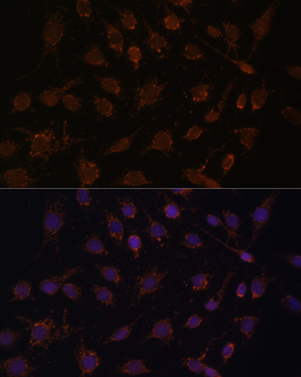 Immunofluorescence - ACAT1 Polyclonal Antibody 