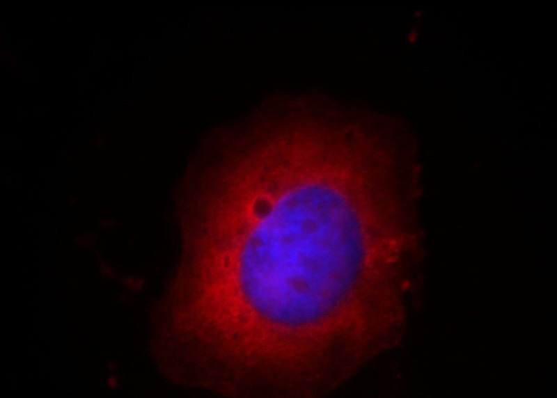 Immunofluorescent analysis of Hela cells, using FST antibody Catalog No: at 1:25 dilution and Rhodamine-labeled goat anti-mouse IgG (red). Blue pseudocolor = DAPI (fluorescent DNA dye).